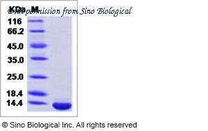 Sino Biological 40471-V08Y1 image 1