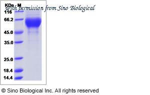 Sino Biological 40476-V08H image 1