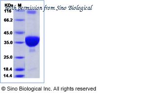 Sino Biological 40524-V08E image 1