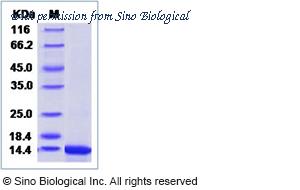 Sino Biological 40543-V08Y image 1