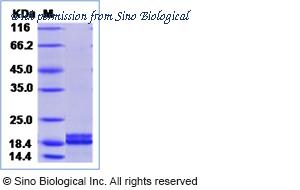 Sino Biological 50203-M08Y image 1