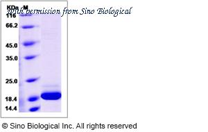 Sino Biological 50669-M08H image 1