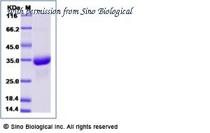 Sino Biological 51094-MNAH-B image 1