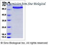 Sino Biological 51149-M02H image 1