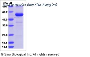 Sino Biological 51156-M02H image 1