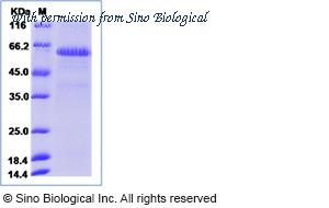 Sino Biological 52984-M02H image 1