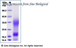 Sino Biological 70052-D07Y image 1