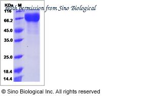 Sino Biological 90051-C02H image 1
