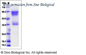 Sino Biological 90111-C02H image 1