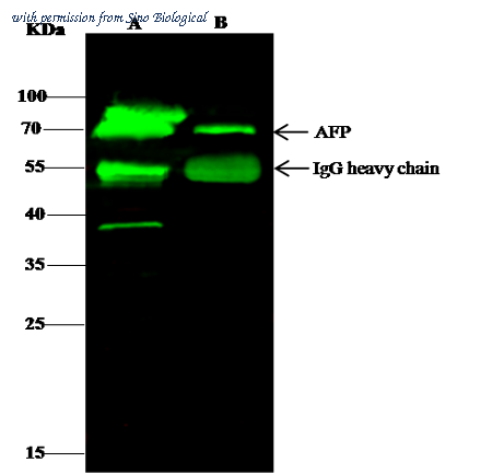 Sino Biological 12177-T52 image 1
