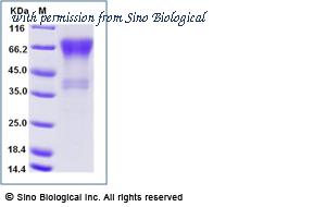 Sino Biological 10039-H41H-B image 1