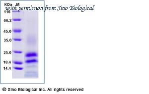 Sino Biological 10334-H41H-B image 1