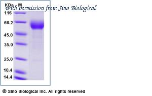 Sino Biological 10357-H02H image 1