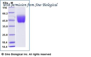 Sino Biological 10419-H08H image 1