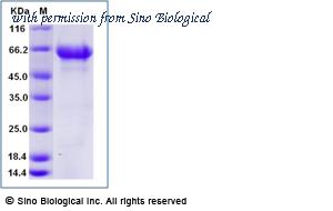 Sino Biological 10481-H02H image 1