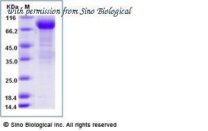 Sino Biological 10518-H02H image 1