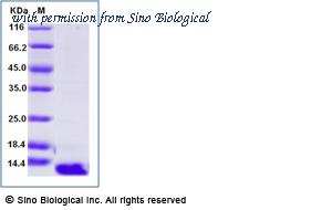 Sino Biological 10577-HNAB image 1