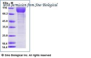 Sino Biological 11069-H02H image 1
