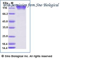 Sino Biological 11192-H02H image 1