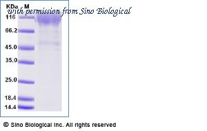 Sino Biological 11202-H08H-B image 1