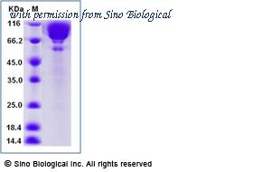 Sino Biological 11503-H02H image 1