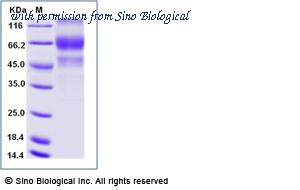 Sino Biological 11524-H41H-B image 1