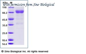 Sino Biological 12163-H02H-B image 1