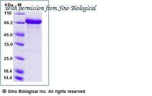 Sino Biological 12177-H02H image 1
