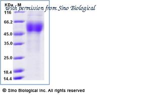 Sino Biological 12302-H08H1 image 1