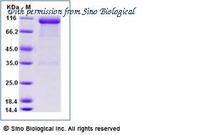 Sino Biological 13667-H02H1 image 1