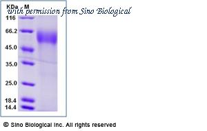 Sino Biological 13735-H08H-B image 1