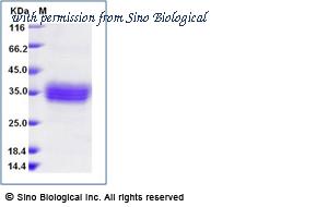 Sino Biological 13976-H08H image 1
