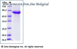 Sino Biological 16075-H02H image 1
