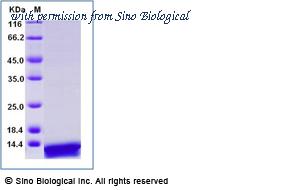 Sino Biological 50228-M08B image 1
