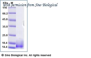 Sino Biological 53809-M07E image 1