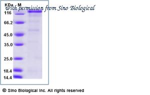 Sino Biological 90147-C02H image 1