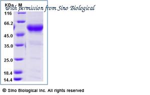 Sino Biological 90888-C02H image 1