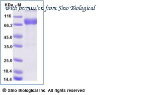 Sino Biological 10012-H02H1-B image 1