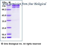 Sino Biological 10103-H02H-B image 1