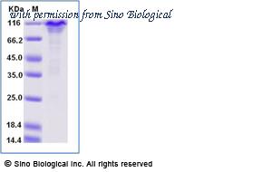 Sino Biological 10204-H02H-B image 1