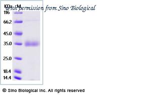 Sino Biological 10352-H07H image 1