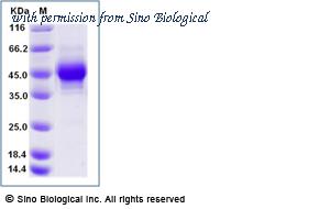 Sino Biological 10818-H27H-B image 1