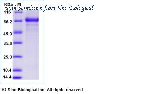Sino Biological 11055-VNAB-B image 1