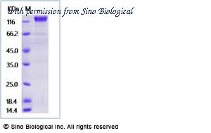 Sino Biological 11825-H02H image 1
