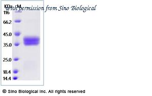 Sino Biological 13699-H08H1 image 1