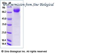 Sino Biological 18366-H02H1 image 1