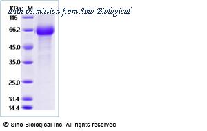 Sino Biological 29749-H02H image 1