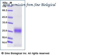Sino Biological 50368-M08B-B image 1