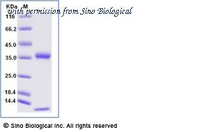 Sino Biological CT084-C27H-B image 1