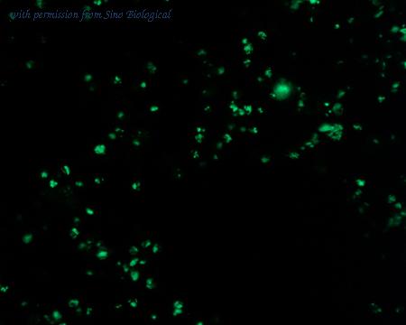 Sino Biological HG11147-ACG image 1